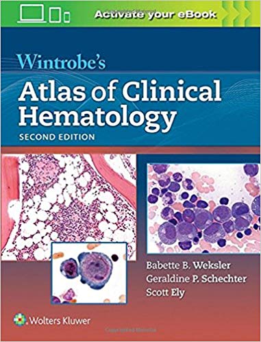 atlas of clinical hematology pdf